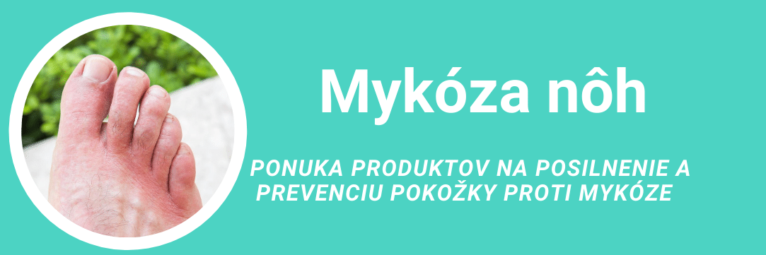 Mykóza nôh